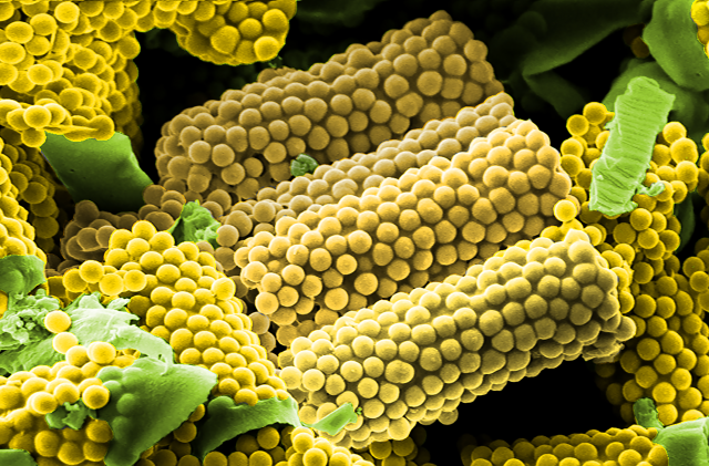 Maisförmiger Wirkstoff-Transporter